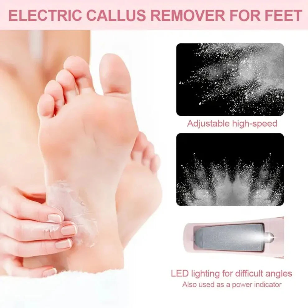 Electric Feet Callus Remover